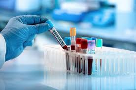 Micronutrient Testing